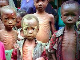 Malnutrition threatens 49k kids in northeast Nigeria, UNICEF warns